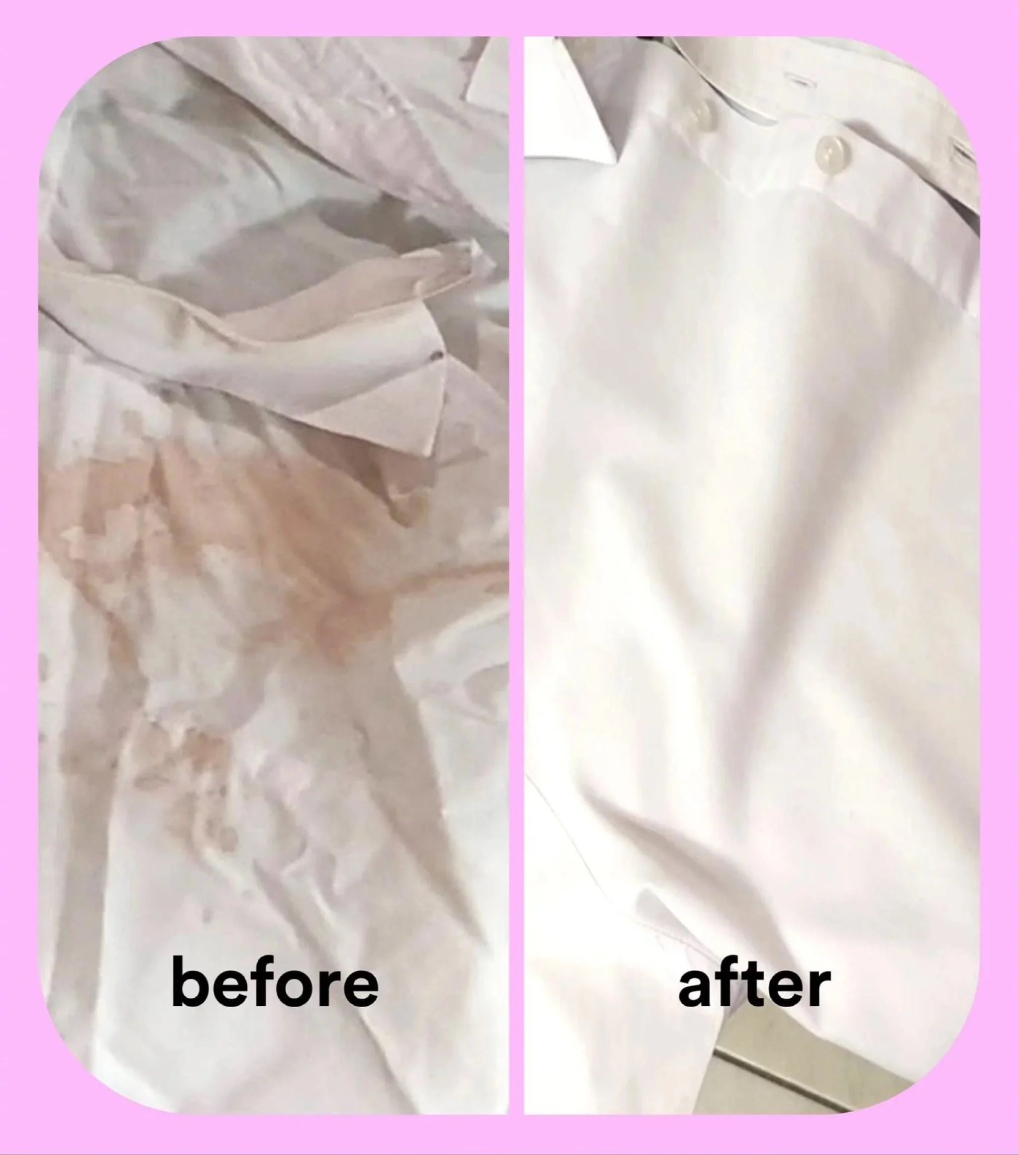 Sensitive Laundry Starter Kit - Image 6